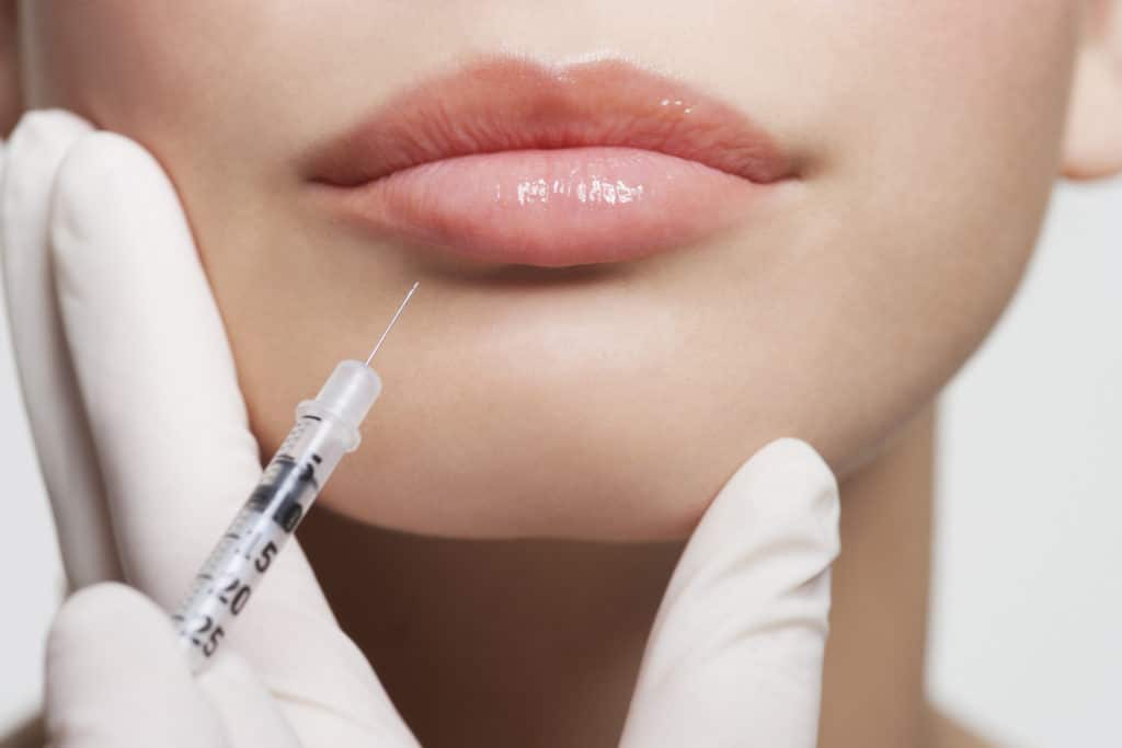 Close up of woman receiving Juvéderm injection in lips