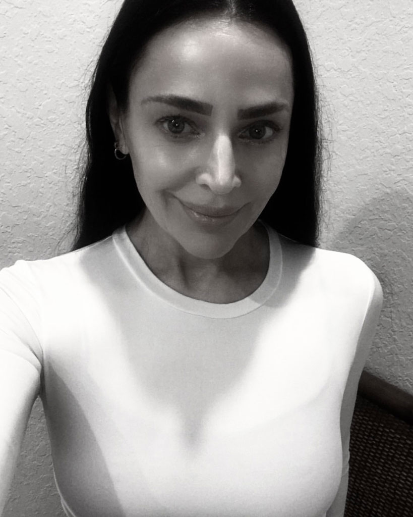 Cosmetic Dermal Fillers Fort Lauderdale FL